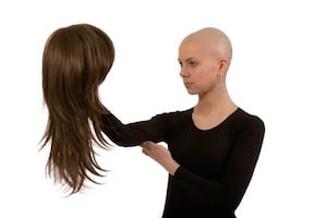 Alopecia: Chemotherapy and Hair Loss